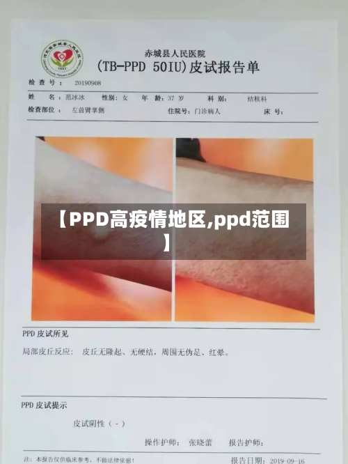 【PPD高疫情地区,ppd范围】