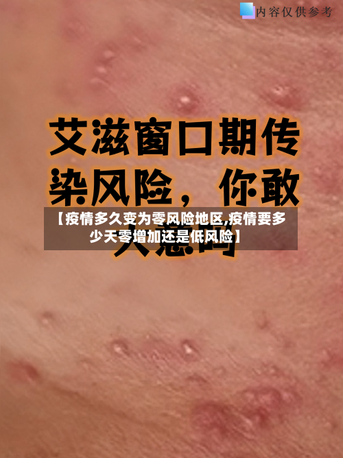 【疫情多久变为零风险地区,疫情要多少天零增加还是低风险】